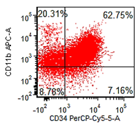 Figure 6c: Flow cytometry, peripheral blood. Blasts (red) are CD45+ (moderate), CD7+, CD11b+, CD34+, and CD117+ (partial). Surface CD3 is negative.